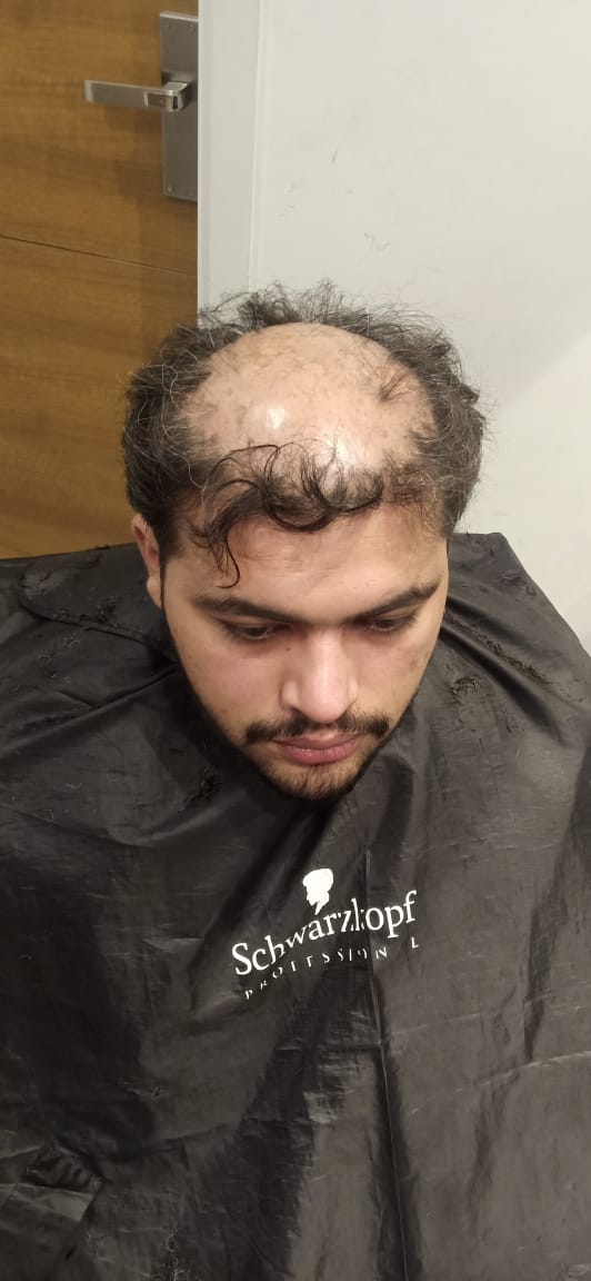 Before - Wig Restyling