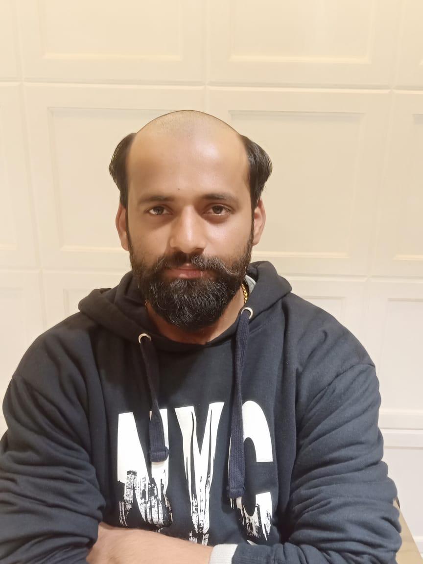 Before - Hair Patch Installation