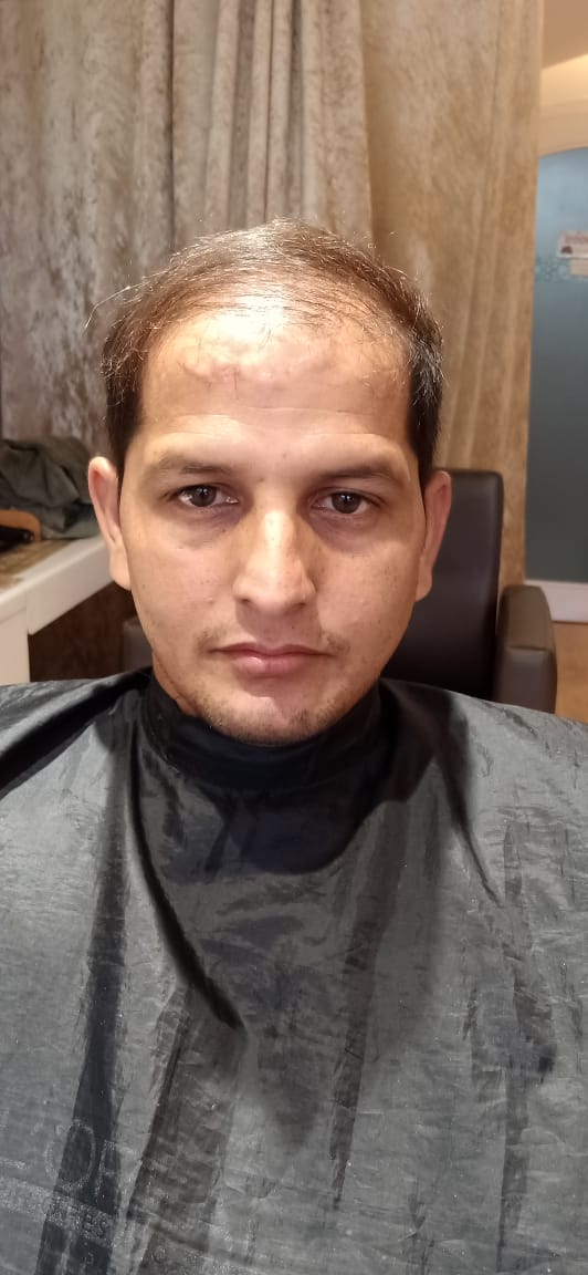 Before - Custom Wig Design