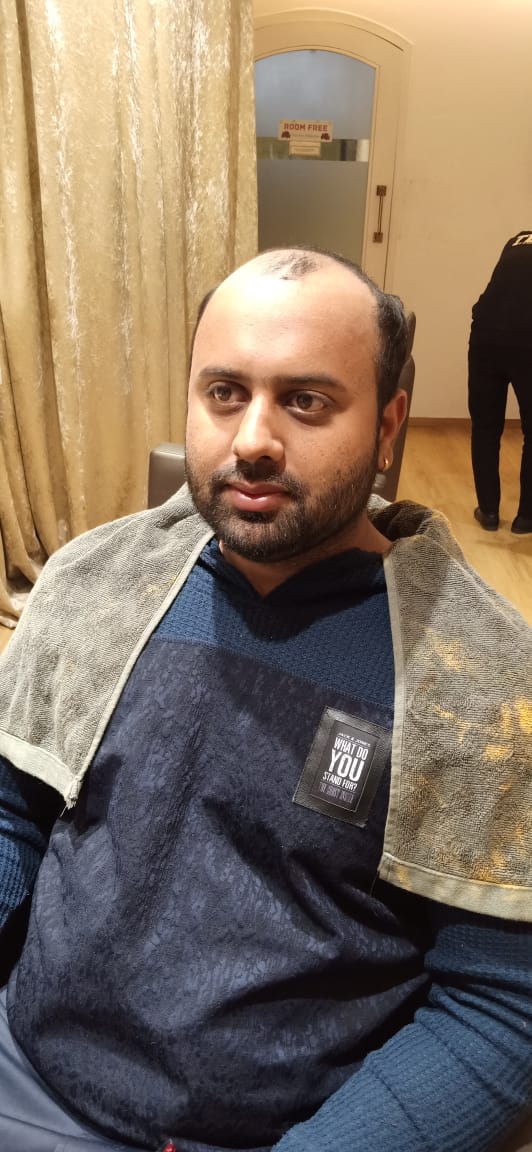 Before - Lace Front Wig